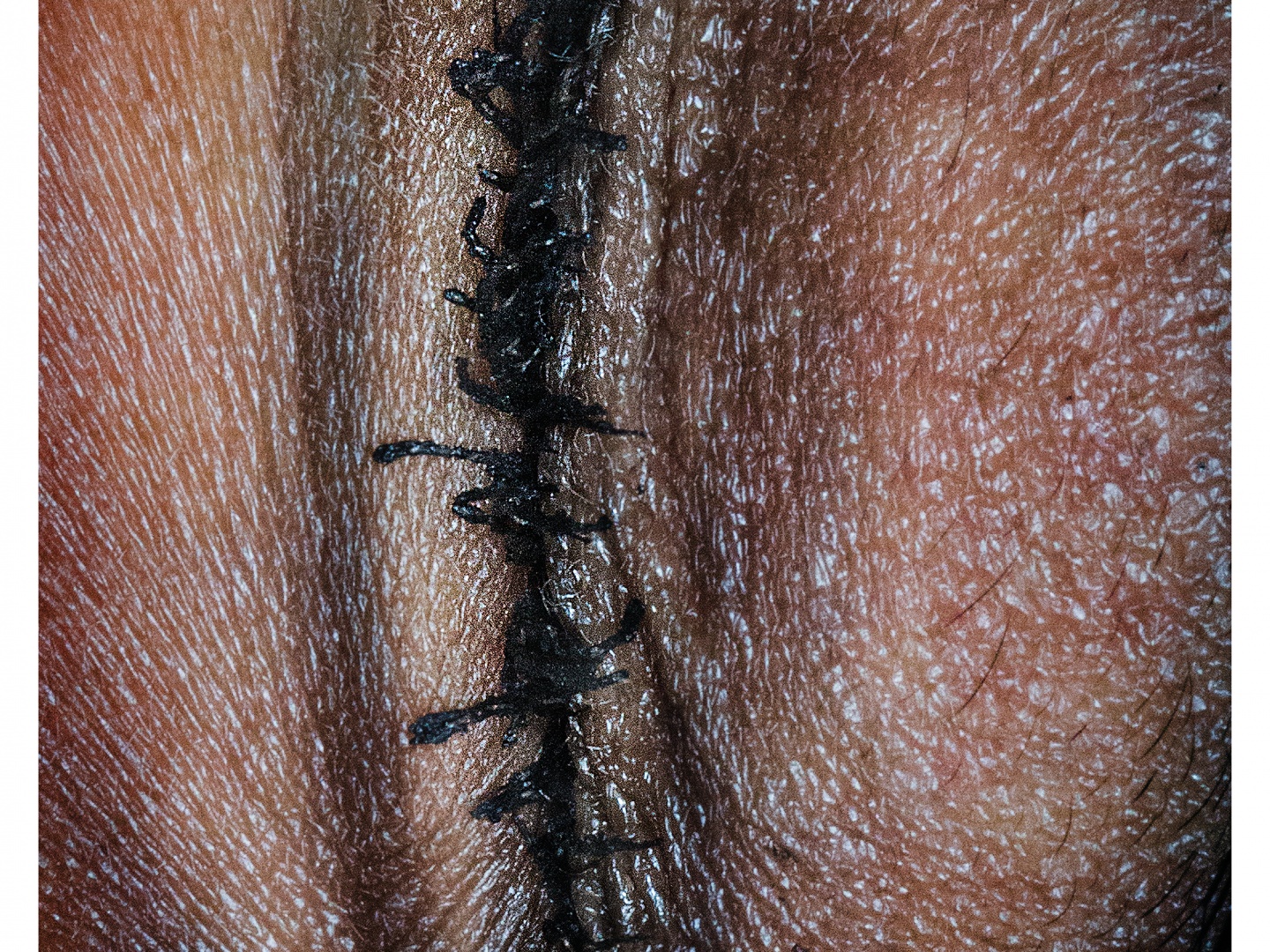 Open your eyes_Binta  Thumbnail